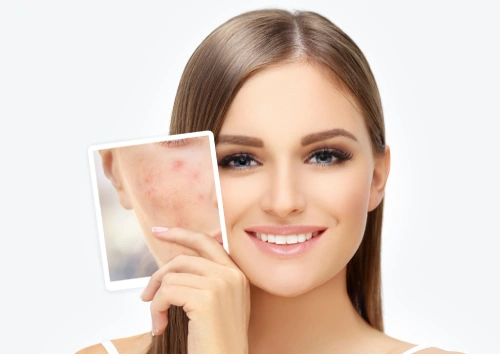 Pigmentation Treatment